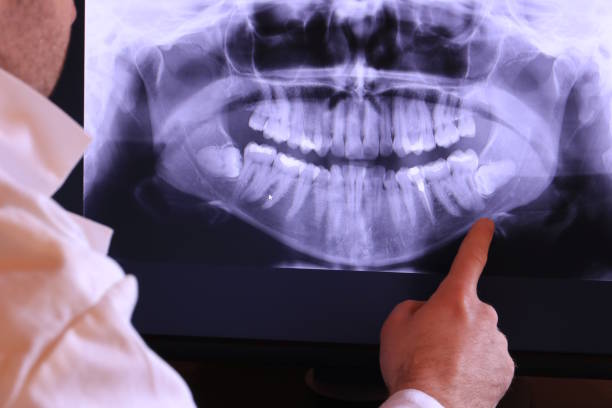 Best Pediatric Emergency Dentist in Manchester, IA